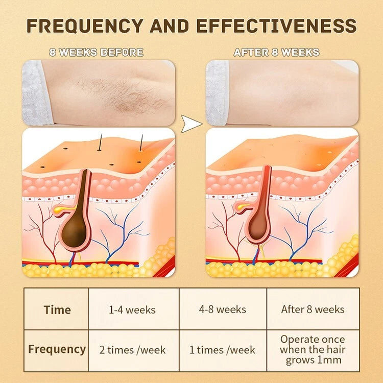 MomDaughts Initia Mini v1 IPL Laser Hair Remover